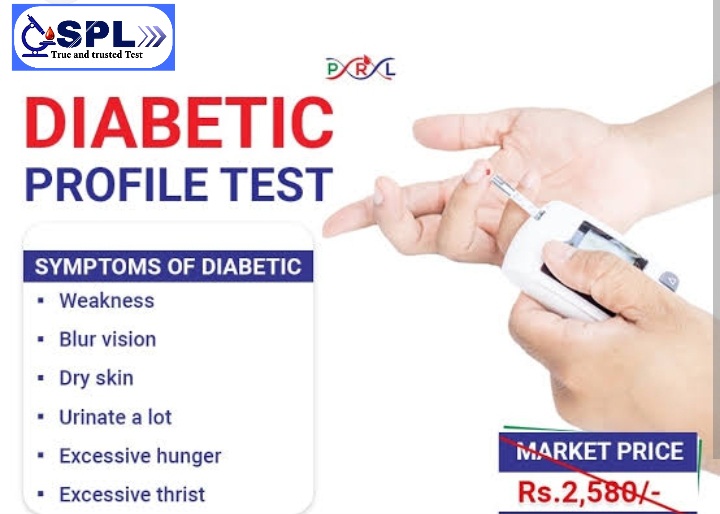 SPL Diabetic Screen GD